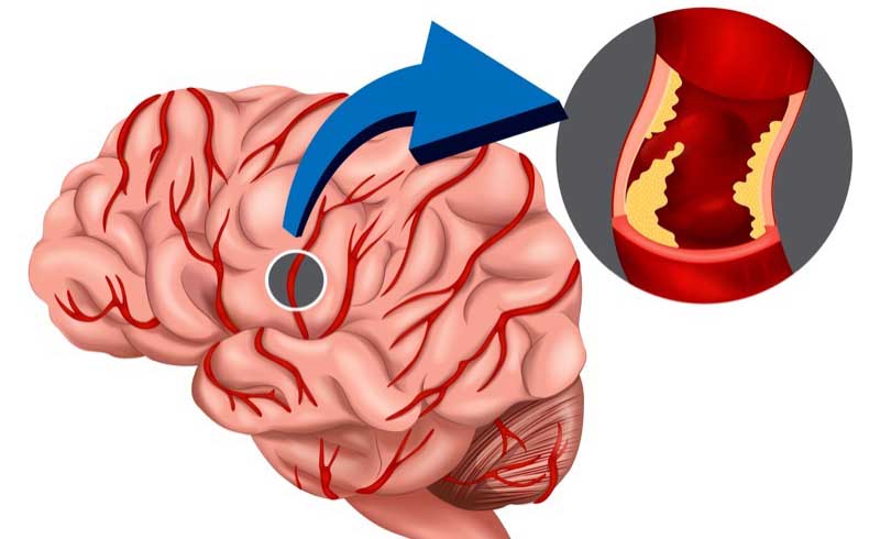 Specialisti delle Neuroscienze si confrontano a Roccalumera