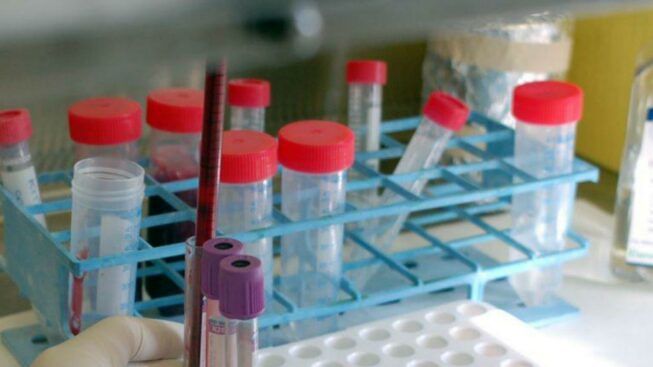 Report Sicilia, oggi tre nuovi contagi