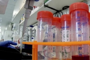 COVID, 24 nuovi casi in Sicilia