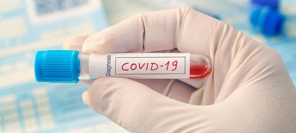 COVID, registrati 46 nuovi casi in Sicilia