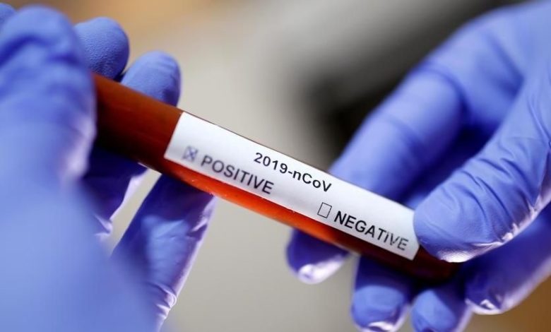 Coronavirus: 77 nuovi positivi in 24 ore