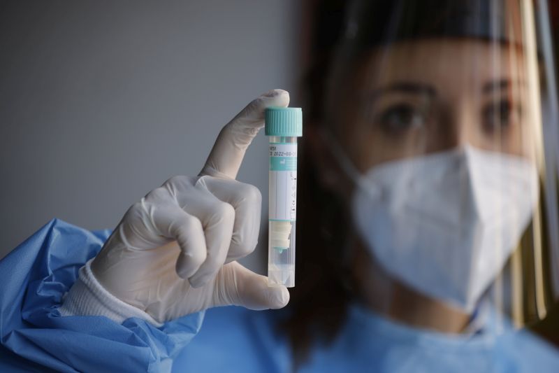 Covid: 5 morti e 260 casi (48 a Messina)