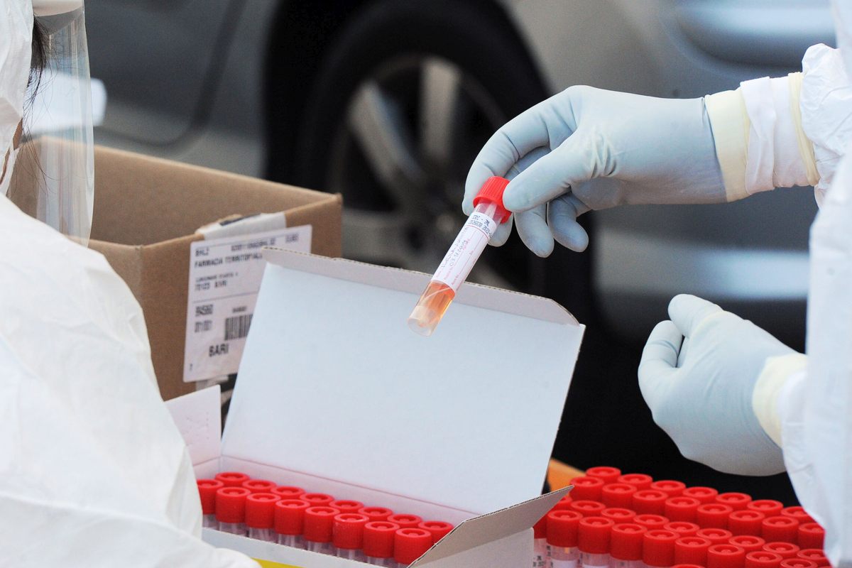 Covid: 777 nuovi casi in Sicilia (110 a Messina)