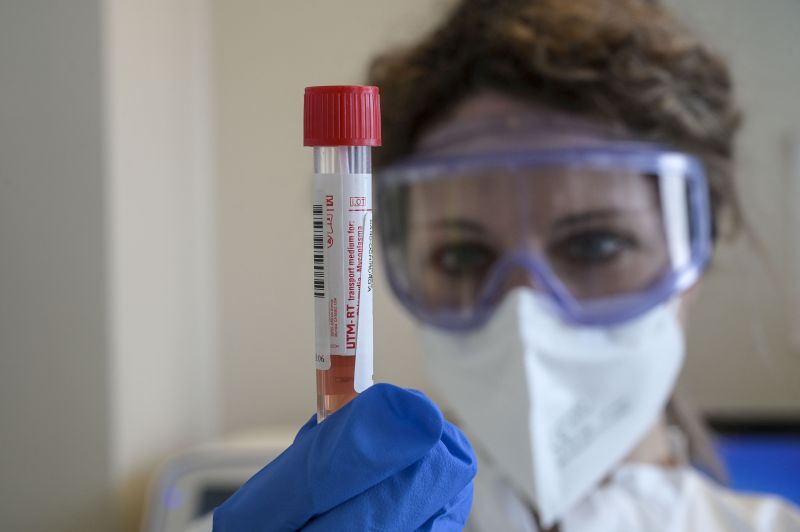 Covid: 1443 nuovi positivi (194 a Messina)