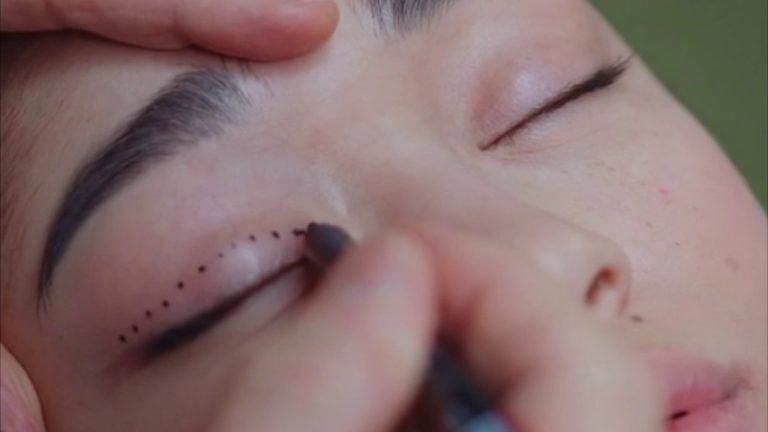 Chirurgia estetica, gli interventi low cost sono un rischio