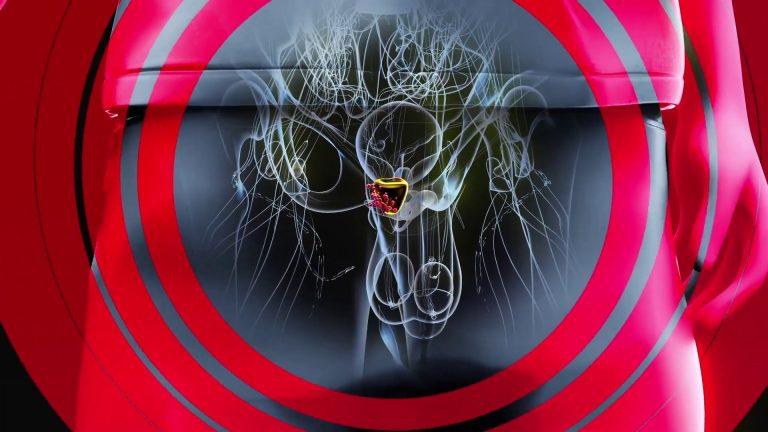 Disturbi della prostata, occhio ai sintomi