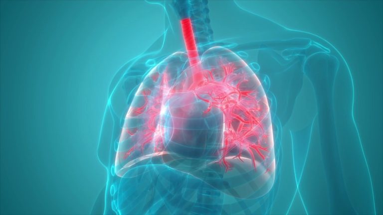 Nuove terapie per la bronchite cronica