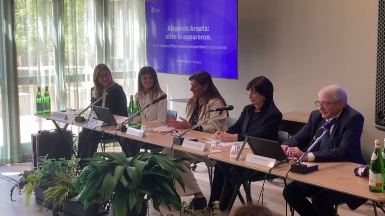 Alopecia, da Pfizer un nuovo trattamento