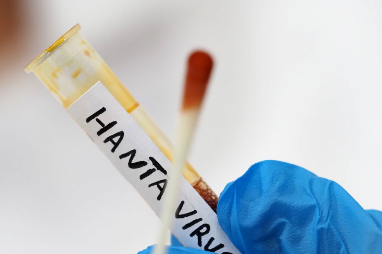 Hantavirus, negativa la paziente argentina ricoverata al Policlinico di Messina