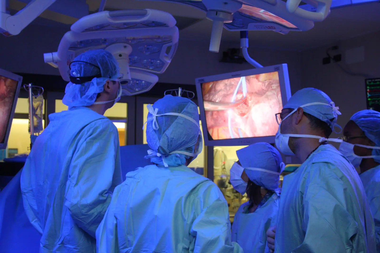All’ISMETT di Palermo eseguita la prima esofagectomia totalmente robotica con Da Vinci