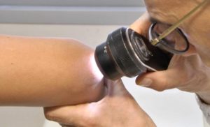 Lotta ad artrite reumatoide e spondiloartrite, oggi screening gratuito al Policlinico