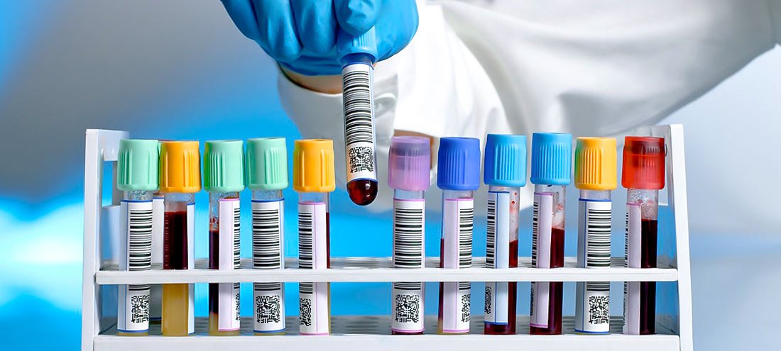 Sciopero, mercoledì i laboratori di analisi cliniche resteranno chiusi