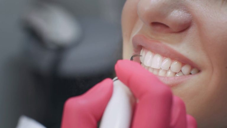 La parodontologia e la ricetta per “salvare” i nostri denti